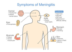 Meningitis